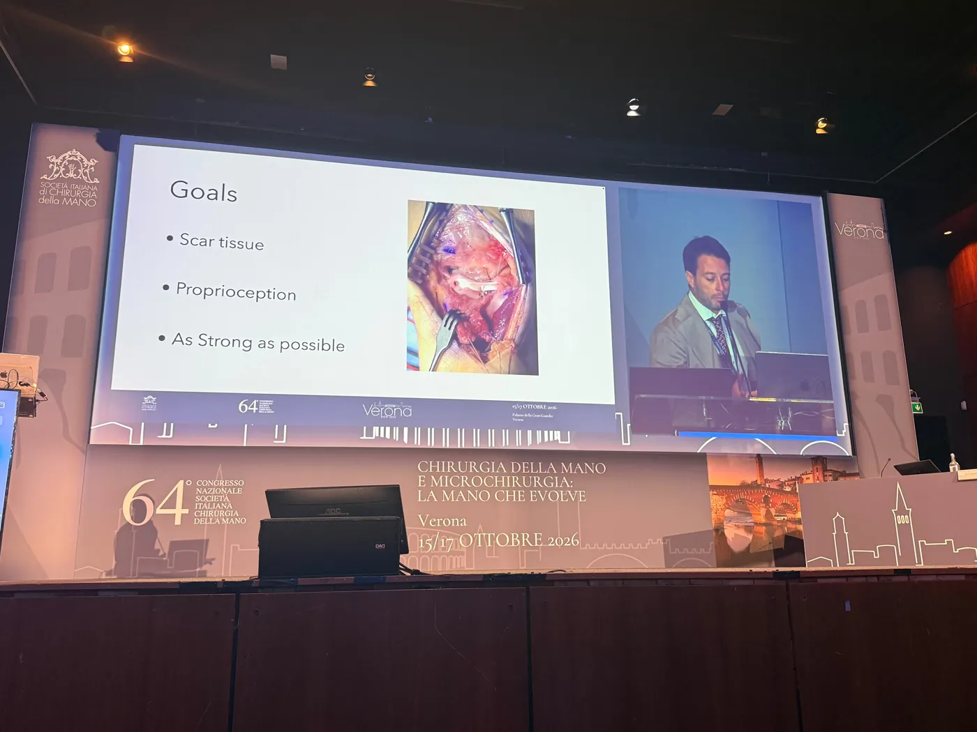 Il Prof. Francesco Smeraglia durante una relazione a un congresso di chirurgia della mano
